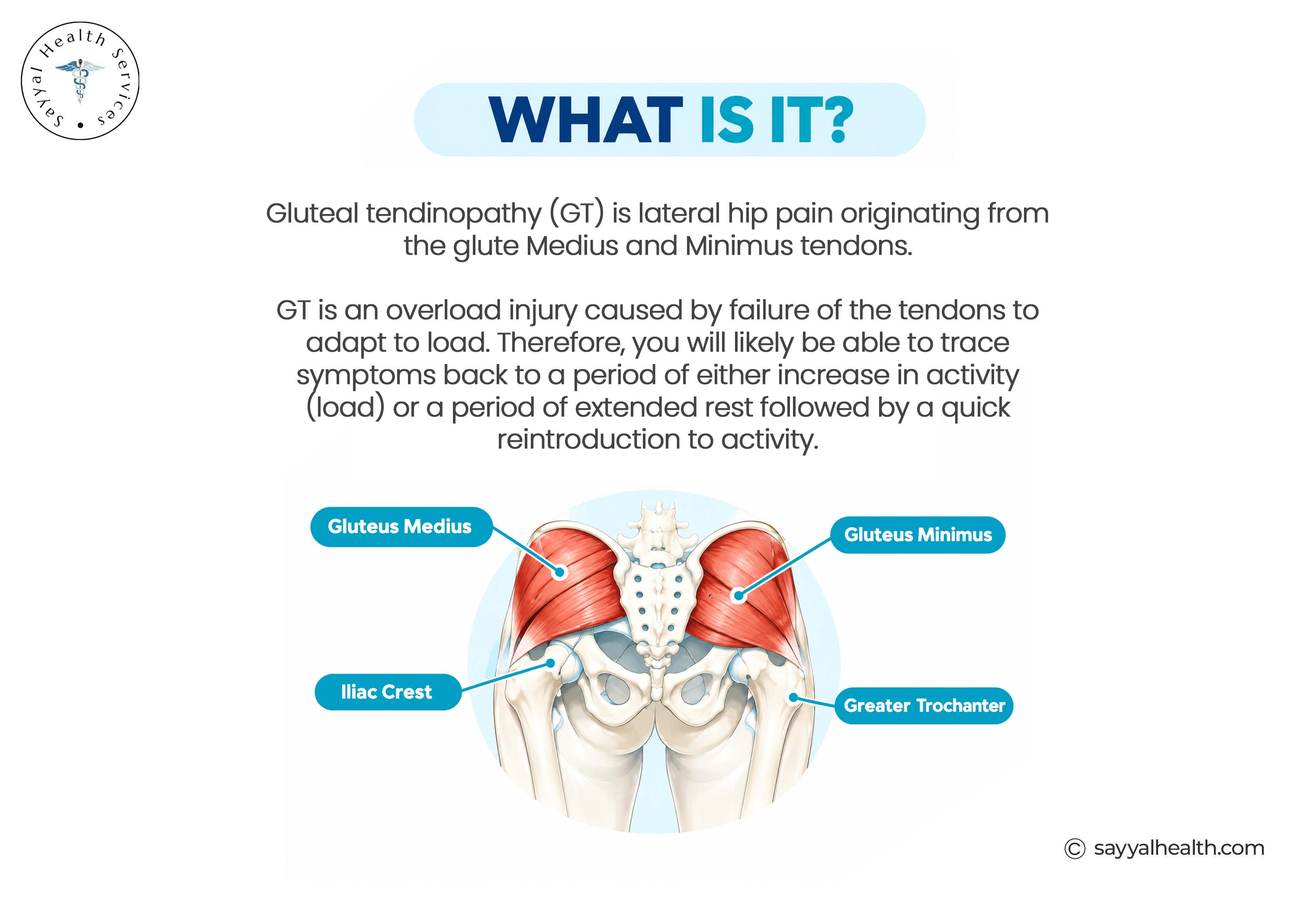 prp for gluteal Tendinopathy
